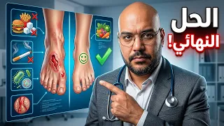 ليه الجرح مش بيخف  أهم   أسباب تمنع التئام الجروح وكيف نعالجها دندنها