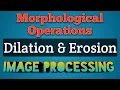Dilation and Erosion in Digital Image Processing Morphological Operations in Image Processing AKTU