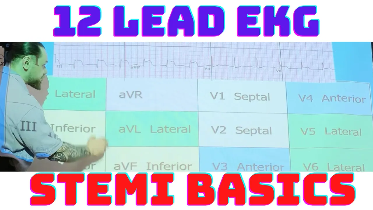 12 Lead EKG STEMI Basics: Inferior, Septal, Anterior, Lateral MI with Coronary Anatomy