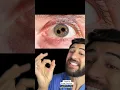 Download Lagu “There’s a Third Eye in my Eyeball” #what