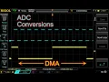 STM32 Timer-based ADC sampling at a specific rate with debug output