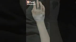 صور ايادي كانها لكي بالمشفى Shorts Kvs Jhope Kpop Subscribe Suga Lalisa Rm 