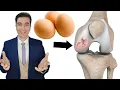 Download Lagu Da li smijete jesti JAJA ako imate bolesne ZGLOBOVE?