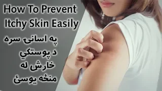 How To Prevent Itchy Skin Easily په اسانۍ سره د پوستکي خارش له منځه يوسئ Afghan Ray 