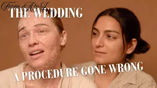 i lasered my face off pre wedding beauty procedure from a to z alix u0026 zoya