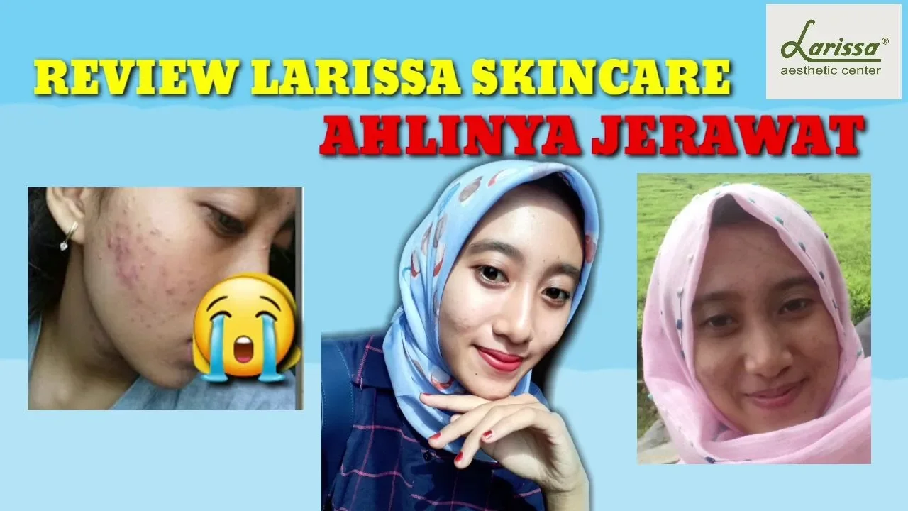 Hai teman-teman, kali ini aku mau sharing pengalaman aku selama perawatan dan menggunakan produk kli. 