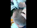 L OREAL SERIOXYL Hair Growth Treatment