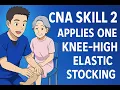 Credentia CNA Skill 2 Applies One Knee-High Elastic Stocking Updated