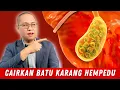 Download Lagu Hilangkan Batu Karang Hempedu CEPAT. Kesan Seawal 2 Hari [Tonton Testimoni]