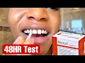 DIY Chipped Tooth Repair At Home Filling HONEST REVIEW Micron Superior