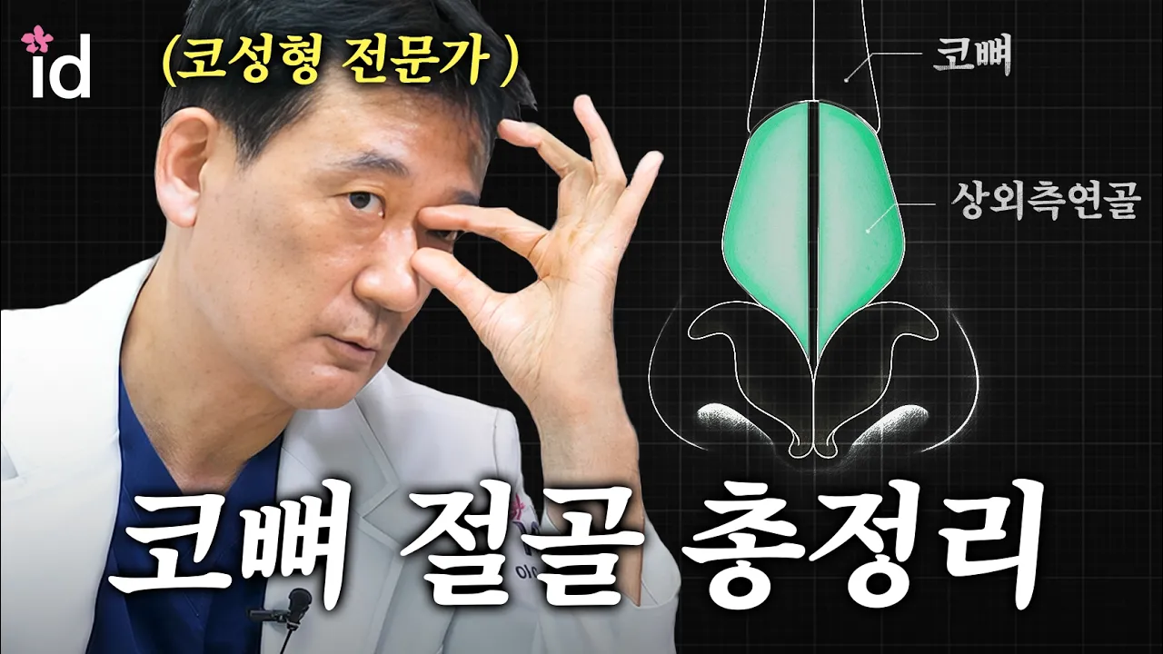 코 성형할 때 코뼈절골 꼭 해야 될까요? l 복원이 어려운 사례 😭
