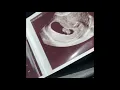 Aaron Carter First Baby Ultrasound Photo s