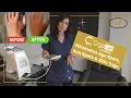 CryoLab at Dolce 202 Removes Age Spots Sun Spots and Skin Tags