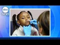 FDA approves nasal spray flu vaccine