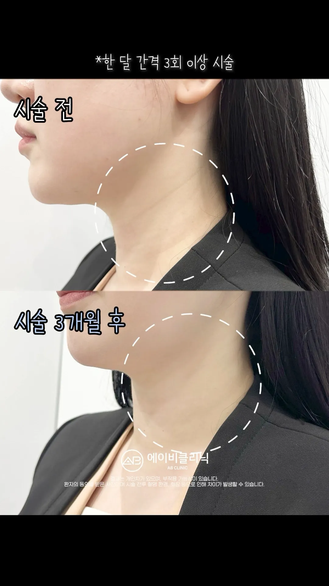 목주름 관리 '이렇게' 해보세요💯