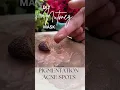 Download Lagu Reduce acne pigmentation Nutmeg जायफल#beauty#shorts #ayurveda #nutmeg #pigmentation #acne