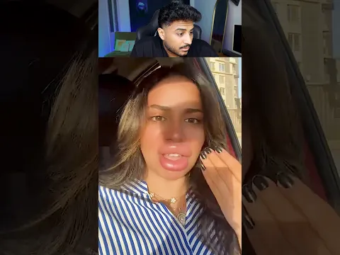 بوقها باظ من الفيلر 😳😳
