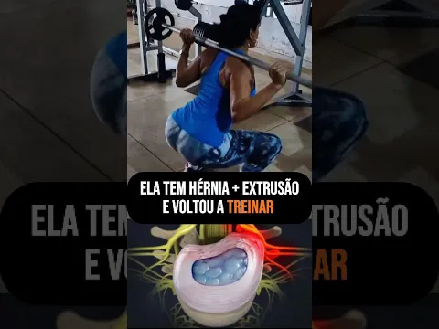 Ela com Hérnia de disco, voltou fazer musculação - FisioPrev