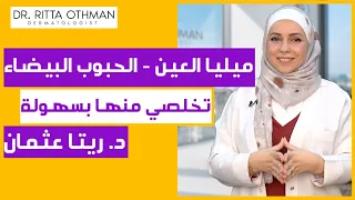 الحبوب البيضاء تحت العين ميليا العين المزعجة تخلصي منها بسهولة 