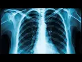 Radiologic examination CPT code - simplify medical coding