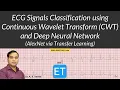ECG Signals Classification using Continuous Wavelet Transform CWT and Deep Neural Network