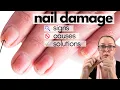 You took off Acrylics Gels or Dip nails and discovered DISASTER What s next