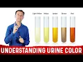 Download Lagu What Urine Color Indicates About Your Body – Dr.Berg