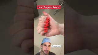 Too many fingers