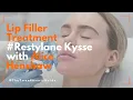 Download Lagu Lip Filler Treatment Review Restylane Kysse with Alice Henshaw MP3