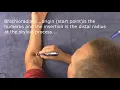 Download Lagu Meridian Pen, Electric Acupuncture pen and how it works.