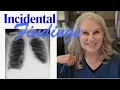 What Are Incidental Findings Nurse Explains