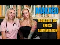 Ep17 I Had a Ruptured Breast Implant for 5 Years and Didn t Know with Rybaby