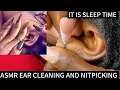ASMR EAR CLEANING VERY SATISFYING FOR THOSE WHO NEED QUICK SLEEP WITH GUM CHEWING AsmrbyBecserah