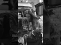 Scary Moment After BBL Surgery She Fainted BBL Gone Wrong