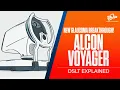 Breakthrough in Glaucoma Treatment Dr Cunningham Explains the Alcon Voyager DSLT