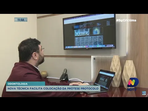 Nova técnica facilita a colocação da prótese protocolo