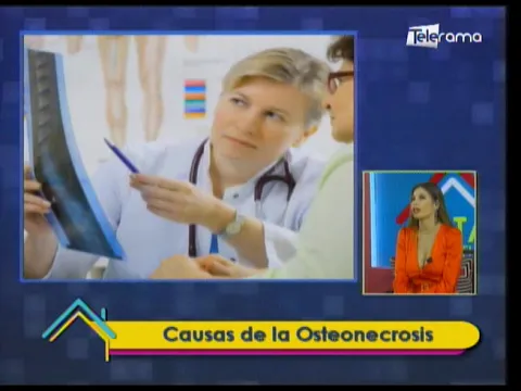 Causas de la Osteonecrosis 