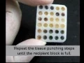 microarray2
