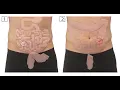 Ileoscopy CPT code - simplify medical coding