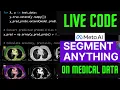 RUNNING SEGMENT ANYTHING SAM 2 MODEL FROM META ON MEDICAL IMAGING DATA