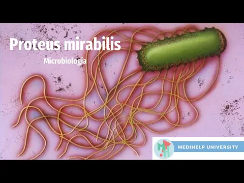 Download MP3 Proteus Mirabilis, la enfermedad de la sonda vesical