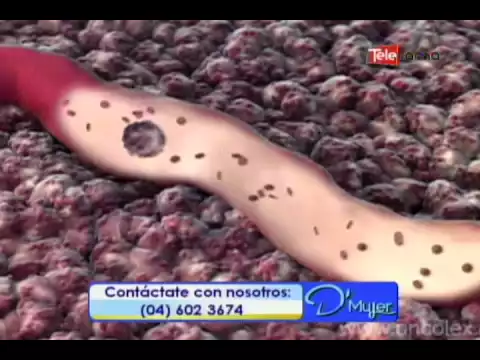 Cáncer de próstata