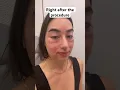 PRP injections for the first time