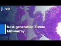 Next-generation Tissue Microarray ngTMA Biomarker Studies Protocol