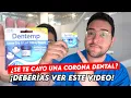 HOW TO ATTACH A DENTAL CROWN AT HOME IN CASE OF EMERGENCY