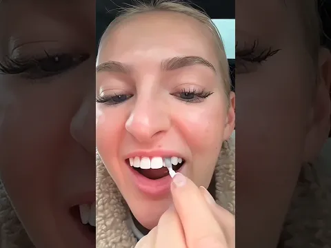 Cara Aneh Memutihkan Gigi! π³