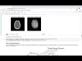 SimpleITK A Simplified Path to Insight Tutorial Registration