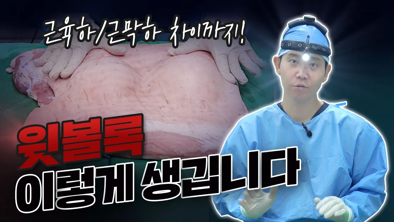 ※실제수술과정공개※ 윗볼록 생기는 이유, 근육하/근막하 차이 다 보여드림!
