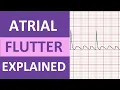 Atrial Flutter ECG Causes Treatment Nursing NCLEX ACLS Heart Rhythm Explained