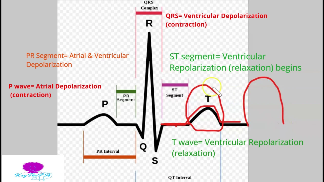 Basic EKG for the Healthcare Professional 1: Waves & Intervals